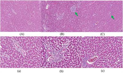 Effects of non-fasting molting on performance, oxidative stress, intestinal morphology, and liver health of laying hens